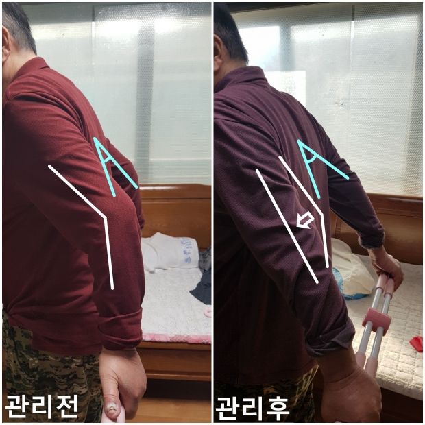 부천시 통합건강돌봄센터 운동영역 서비스 대상자의 어깨 및 팔꿈치 움직임 향상 모습.