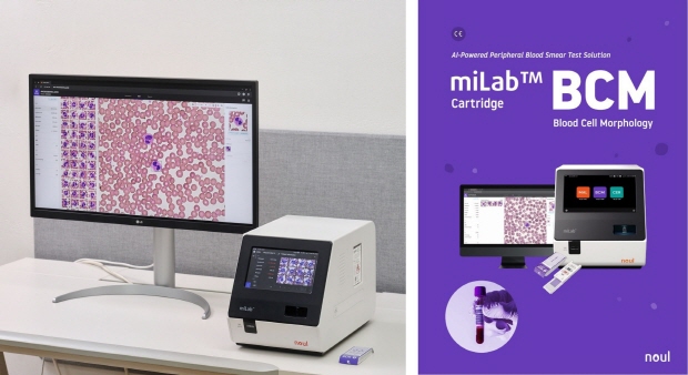 [사진] 노을의 AI 혈액 분석 솔루션 ‘miLab™ BCM’ 이미지