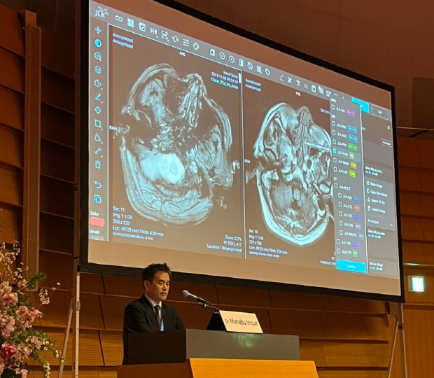 日 국립뇌심혈관센터 이노우에 마나부 교수가 지난 달 일본 오사카에서 개최된 STROKE 2025 JAPAN에 참여해 일본 의료진을 대상으로 JLK 뇌졸중 AI 솔루션 적용 사례를 발표하고 있다.
